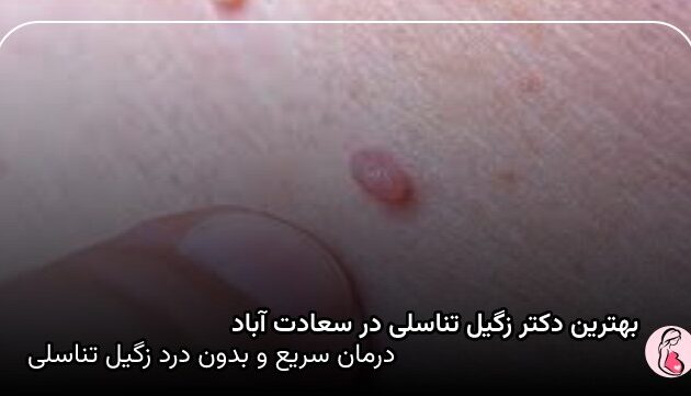 بهترین دکتر زگیل تناسلی در سعادت آباد