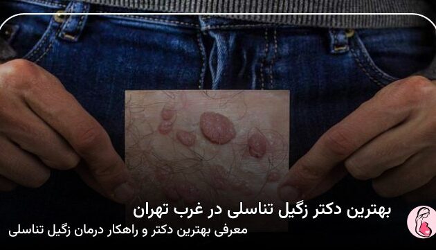 بهترین دکتر زگیل تناسلی در غرب تهران
