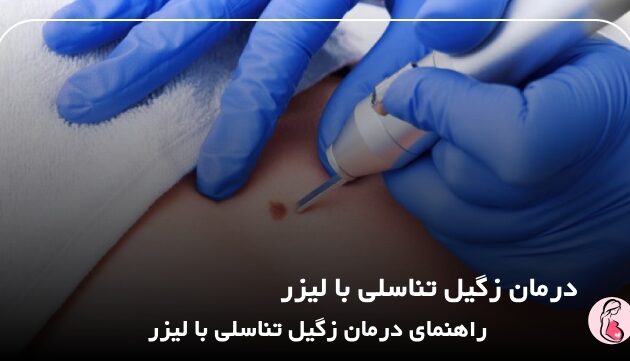 درمان زگیل تناسلی با لیزر