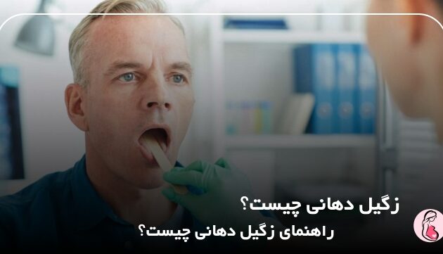 زگیل دهانی چیست؟