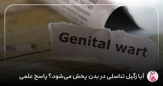 آیا زگیل تناسلی در بدن پخش می‌شود؟ پاسخ علمی