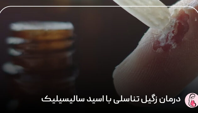 درمان زگیل تناسلی با اسید سالیسیلیک