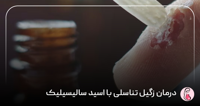 درمان زگیل تناسلی با اسید سالیسیلیک
