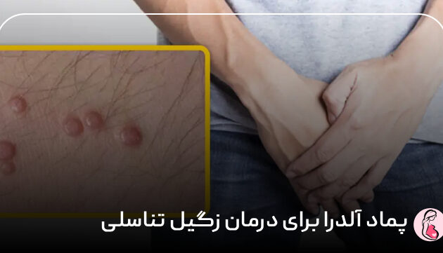 پماد آلدرا برای درمان زگیل تناسلی
