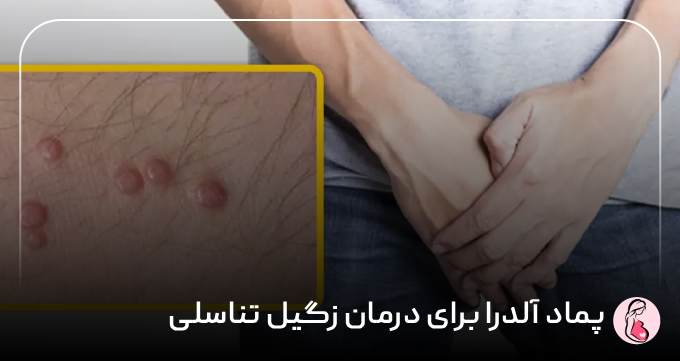 پماد آلدرا برای درمان زگیل تناسلی